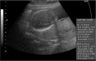 Measuring the baby's head